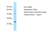 ISOC1 Antibody -  This image was taken for the unconjugated form of this product. Other forms have not been tested.