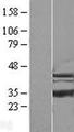 ISOC1 Protein - Western validation with an anti-DDK antibody * L: Control HEK293 lysate R: Over-expression lysate