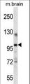ITCH / AIP4 Antibody - ITCH Antibody western blot of mouse brain tissue lysates (35 ug/lane). The ITCH antibody detected the ITCH protein (arrow).