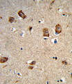 ITGA1/CD49a/Integrin Alpha 1 Antibody - Formalin-fixed and paraffin-embedded human brain tissue reacted with ITGA1 Antibody , which was peroxidase-conjugated to the secondary antibody, followed by DAB staining. This data demonstrates the use of this antibody for immunohistochemistry; clinical relevance has not been evaluated.