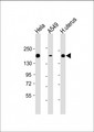 ITGA11 / Integrin Alpha 11 Antibody - All lanes: Anti-ITGA11 Antibody at 1:2000 dilution Lane 1: Hela whole cell lysate Lane 2: A549 whole cell lysate Lane 3: human uterus lysate Lysates/proteins at 20 µg per lane. Secondary Goat Anti-mouse IgG, (H+L), Peroxidase conjugated at 1/10000 dilution. Predicted band size: 133 kDa Blocking/Dilution buffer: 5% NFDM/TBST.