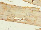 ITGA11 / Integrin Alpha 11 Antibody - Immunohistochemistry of paraffin-embedded human skeletal muscle tissue at dilution 1:100
