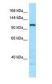 ITGA5/Integrin Alpha 5/CD49e Antibody - ITGA5/Integrin Alpha 5/CD49e antibody Western Blot of MDA-MB-435S.  This image was taken for the unconjugated form of this product. Other forms have not been tested.