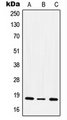 ITGA5/Integrin Alpha 5/CD49e Antibody - Western blot analysis of CD49e LC expression in HeLa LPS-treated (A); NIH3T3 LPS-treated (B); rat kidney (C) whole cell lysates.
