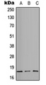 ITGA5/Integrin Alpha 5/CD49e Antibody - Western blot analysis of CD49e HC expression in HEK293T (A); Raw264.7 (B); PC12 (C) whole cell lysates.