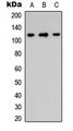 ITGA8 / Integrin Alpha 8 Antibody - Western blot analysis of Integrin alpha 8 HC expression in HeLa (A); Raw264.7 (B); PC12 (C) whole cell lysates.