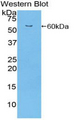 ITGA9 / Integrin Alpha 9 Antibody - Western blot of recombinant ITGA9 / Integrin Alpha 9.  This image was taken for the unconjugated form of this product. Other forms have not been tested.