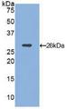 ITGAD / CD11d Antibody - Western Blot; Sample: Recombinant ITGaD, Mouse.