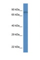 ITGB1 / Integrin Beta 1 / CD29 Antibody - ITGB1 / Integrin Beta 1 antibody Western blot of Mouse Heart lysate. Antibody concentration 1 ug/ml.  This image was taken for the unconjugated form of this product. Other forms have not been tested.