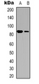 ITGB3 / Integrin Beta 3 / CD61 Antibody - Western blot analysis of CD61 expression in HUVEC (A); NIH3T3 (B) whole cell lysates.
