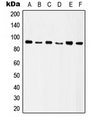 ITGB5 / Integrin Beta 5 Antibody - Western blot analysis of Integrin beta 5 expression in HeLa (A); SW480 (B); HT29 (C); A549 (D); Raw264.7 (E); rat kidney (F) whole cell lysates.