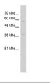 ITGBL1 Antibody - HepG2 Cell Lysate.  This image was taken for the unconjugated form of this product. Other forms have not been tested.