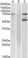 ITK / EMT Antibody - HEK293 lysate (10ug protein in RIPA buffer) overexpressing Human (ITK) with DYKDDDDK tag probed with Goat Anti-ITK Antibody (1ug/ml) in Lane A and probed with anti-DYKDDDDK Tag (1/10000) in lane C. Mock-transfected HEK293 probed with Goat Anti-ASNSD1 Antibody (1mg/ml) in Lane B. Primary incubations were for 1 hour. Detected by chemiluminescencence.