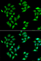 ITLN1 / Omentin Antibody - Immunofluorescence analysis of HeLa cells.