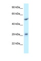 ITM2C Antibody - ITM2C antibody Western blot of Jurkat Cell lysate. Antibody concentration 1 ug/ml.  This image was taken for the unconjugated form of this product. Other forms have not been tested.