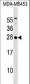 ITPA Antibody - ITPA Antibody western blot of MDA-MB453 cell line lysates (35 ug/lane). The ITPA antibody detected the ITPA protein (arrow).