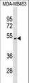 ITPK1 Antibody - ITPK1 Antibody western blot of MDA-MB453 cell line lysates (35 ug/lane). The ITPK1 antibody detected the ITPK1 protein (arrow).