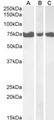 ITPKC Antibody - Goat Anti-IP3KC Antibody (1µg/ml) staining of Human Pancreas (A), Heart (B) and Skeletal Muscle (C) lysates (35µg protein in RIPA buffer). Primary incubation was 1 hour. Detected by chemiluminescencence.