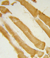 ITPKC Antibody - Formalin-fixed and paraffin-embedded human skeletal muscle reacted with ITPKC Antibody , which was peroxidase-conjugated to the secondary antibody, followed by DAB staining. This data demonstrates the use of this antibody for immunohistochemistry; clinical relevance has not been evaluated.