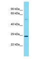 ITPRIPL2 Antibody - ITPRIPL2 antibody Western Blot of HeLa. Antibody dilution: 1 ug/ml.  This image was taken for the unconjugated form of this product. Other forms have not been tested.