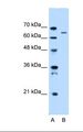 IVL / Involucrin Antibody - Lane A: Marker. Lane B: HepG2 cell lysate. Antibody concentration: 0.5 ug/ml. Gel concentration: 12%.  This image was taken for the unconjugated form of this product. Other forms have not been tested.