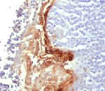 IVL / Involucrin Antibody - IHC analysis of FFPE human tonsil tissue and Involucrin antibody.