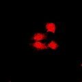 JADE1 / PHF17 Antibody - Immunofluorescent analysis of PHF17 staining in U2OS cells. Formalin-fixed cells were permeabilized with 0.1% Triton X-100 in TBS for 5-10 minutes and blocked with 3% BSA-PBS for 30 minutes at room temperature. Cells were probed with the primary antibody in 3% BSA-PBS and incubated overnight at 4 deg C in a humidified chamber. Cells were washed with PBST and incubated with a DyLight 594-conjugated secondary antibody (red) in PBS at room temperature in the dark.