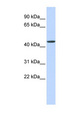 JMJD4 Antibody - JMJD4 antibody Western blot of Fetal Heart lysate. This image was taken for the unconjugated form of this product. Other forms have not been tested.