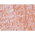 JMJD6 / PSR Antibody - Immunohistochemistry of JMJD6 in rat brain tissue with JMJD6 antibody at 2.5 µg/mL.
