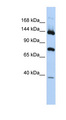 JMJD7 Antibody - PLA2G4B / CPLA2-Beta antibody Western blot of Fetal Brain lysate. This image was taken for the unconjugated form of this product. Other forms have not been tested.
