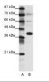 JUN / c-Jun Antibody - A: Marker, B: 293T Cell Lysate.  This image was taken for the unconjugated form of this product. Other forms have not been tested.