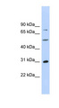 Junctin / ASPH Antibody - ASPH antibody Western blot of MCF7 cell lysate. This image was taken for the unconjugated form of this product. Other forms have not been tested.