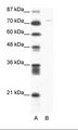 Junctin / ASPH Antibody - A: Marker, B: Jurkat Cell Lysate.  This image was taken for the unconjugated form of this product. Other forms have not been tested.