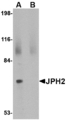Junctophilin 2 / JPH2 Antibody - Western blot of JPH2 in 293 cell lysate with JPH2 antibody at 2 ug/ml in (A) the absence and (B) the presence of blocking peptide