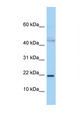 JUNDM2 / JDP2 Antibody - JDP2 antibody Western blot of 3 Cell lysate. Antibody concentration 1 ug/ml.  This image was taken for the unconjugated form of this product. Other forms have not been tested.