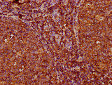 Kappa Light Chain Antibody - Immunohistochemistry Dilution at 1:200 and staining in paraffin-embedded human tonsil tissue performed on a Leica BondTM system. After dewaxing and hydration, antigen retrieval was mediated by high pressure in a citrate buffer (pH 6.0). Section was blocked with 10% normal Goat serum 30min at RT. Then primary antibody (1% BSA) was incubated at 4°C overnight. The primary is detected by a biotinylated Secondary antibody and visualized using an HRP conjugated SP system.