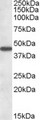KATII / AADAT Antibody - AADAT antibody (1 ug/ml) staining of Human Liver lysate (35 ug protein/ml in RIPA buffer). Primary incubation was 1 hour. Detected by chemiluminescence.