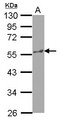 KATNA1 Antibody - Sample (30 ug of whole cell lysate) A: HepG2 10% SDS PAGE KATNA1 antibody diluted at 1:1000