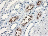 KATNB1 Antibody - IHC of paraffin-embedded Human Kidney tissue using anti-KATNB1 mouse monoclonal antibody.