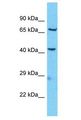 KBTBD11 Antibody - KBTBD11 antibody Western Blot of Jurkat. Antibody dilution: 1 ug/ml.  This image was taken for the unconjugated form of this product. Other forms have not been tested.