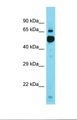 KBTBD11 Antibody - Western blot of Human Hela. KBTBD11 antibody dilution 1.0 ug/ml.  This image was taken for the unconjugated form of this product. Other forms have not been tested.