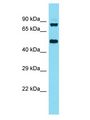 KBTBD6 Antibody - KBTBD6 antibody Western Blot of HeLa. Antibody dilution: 1 ug/ml.  This image was taken for the unconjugated form of this product. Other forms have not been tested.