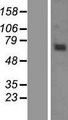 KBTBD6 Protein - Western validation with an anti-DDK antibody * L: Control HEK293 lysate R: Over-expression lysate