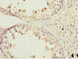 KBTBD7 Antibody - Immunohistochemistry of paraffin-embedded human testis tissue at dilution 1:100