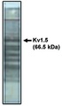 KCNA5 / Kv1.5 Antibody - Western blot of Kv1.5 antibody on rat brain lysate.