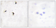 KCNB1 / Kv2.1 Antibody - Immunohistochemistry analysis of paraffin-embedded human brain tissue, using Kv2.1/KCNB1 Antibody. The picture on the right is blocked with the synthesized peptide.