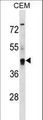 KCNG2 Antibody - KCNG2 Antibody western blot of CEM cell line lysates (35 ug/lane). The KCNG2 antibody detected the KCNG2 protein (arrow).