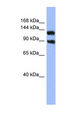 KCNH3 / Kv12.2 Antibody - KCNH3 / Kv12.2 antibody Western blot of OVCAR-3 cell lysate. This image was taken for the unconjugated form of this product. Other forms have not been tested.