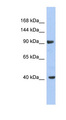 KCNH6 / Kv11.2 / ERG2 Antibody - KCNH6 / Kv11.2 antibody Western blot of NCI-H226 cell lysate. This image was taken for the unconjugated form of this product. Other forms have not been tested.