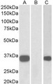 KCNIP3 / Dream / Calsenilin Antibody - HEK293 lysate (10ug protein in RIPA buffer) overexpressing Human KCNIP3 with C-terminal MYC tag probed with (1ug/ml) in Lane A and probed with anti-MYC Tag (1/1000) in lane C. Mock-transfected HEK293 probed (1mg/ml) in Lane B. Primary